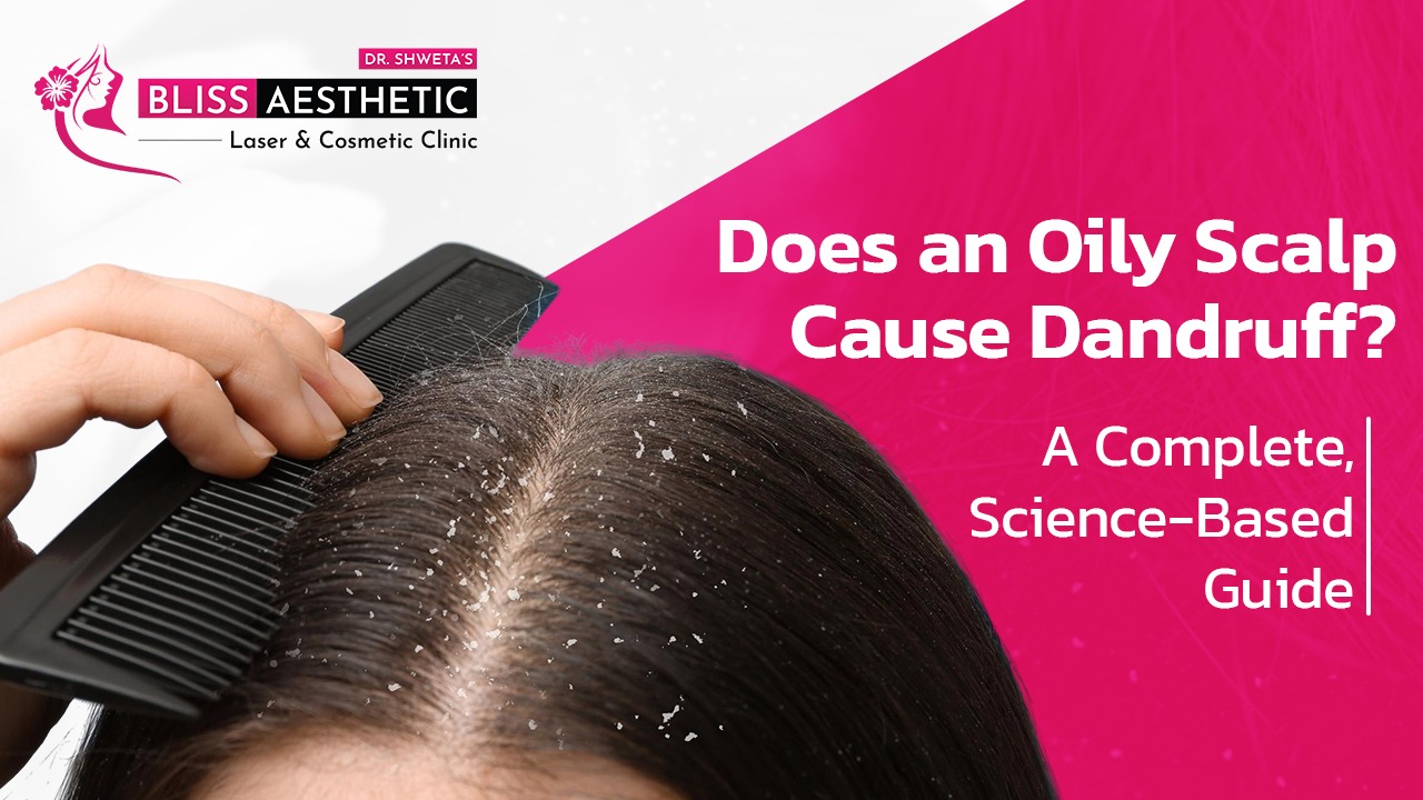 Does an Oily Scalp Cause Dandruff? A Complete, Science-Based Guide
