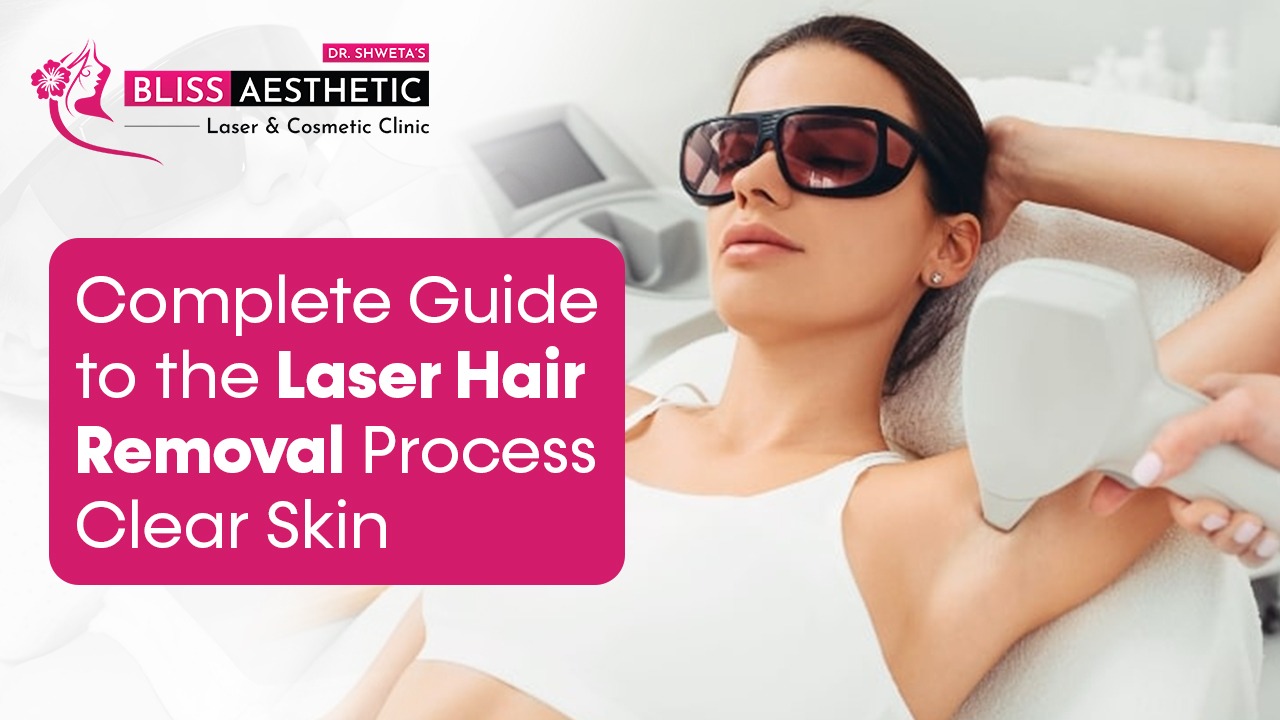 Complete Guide To the Laser Hair Removal Process for Clear Skin