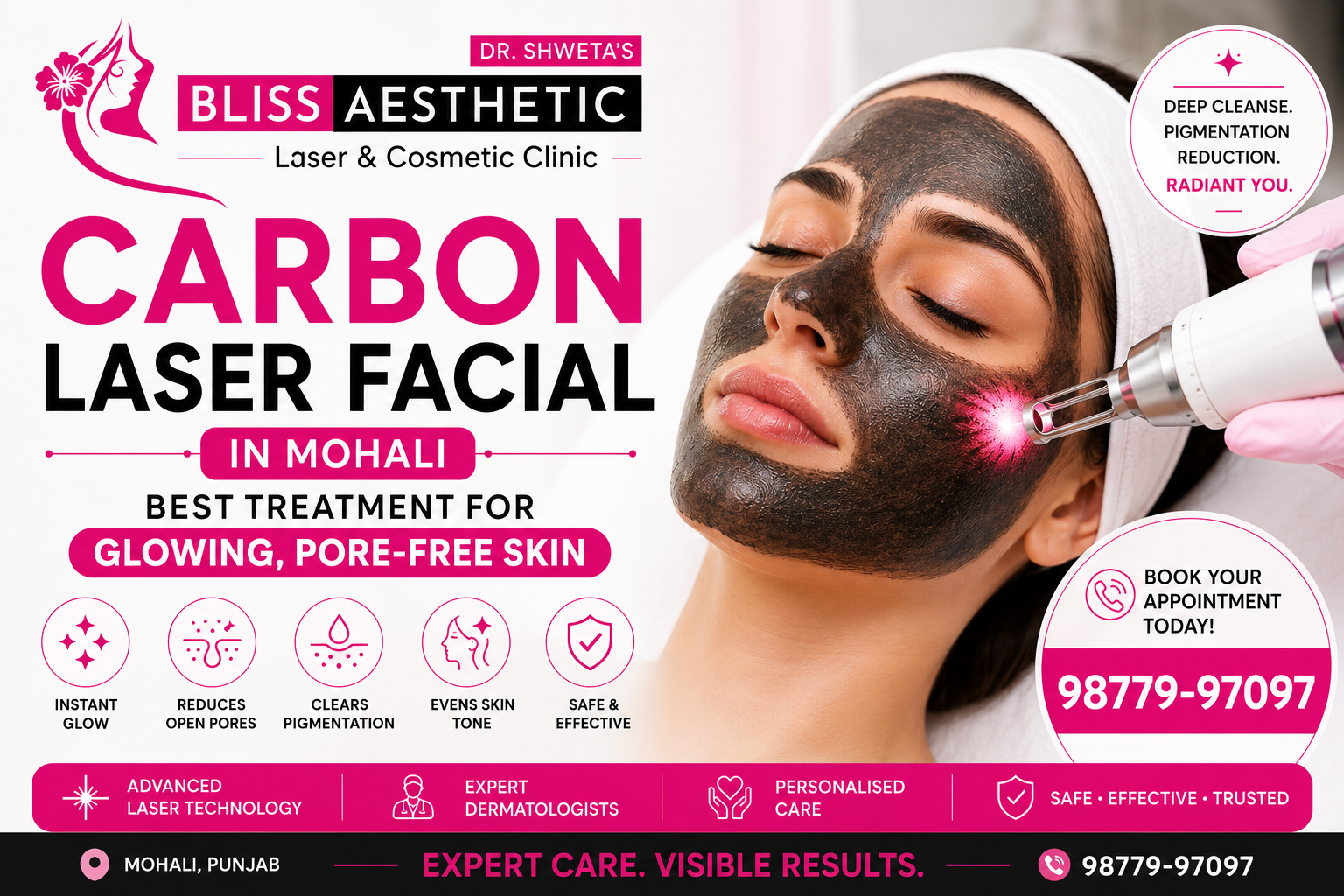 Carbon Laser Facial in Mohali – Best Treatment for Glowing, Pore-Free Skin